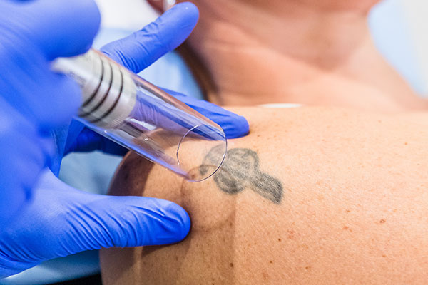 How to be afraid of needles but have plenty of tattoos - Quora