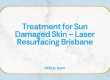 Treatment for Sun Damaged Skin – Laser Resurfacing Brisbane
