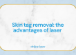 Skin Tag Removal - The advantages of laser