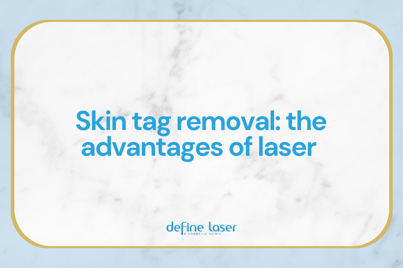 skin-tag-removal-the-advantages-of-laser Skin Tag Removal - The advantages of laser
