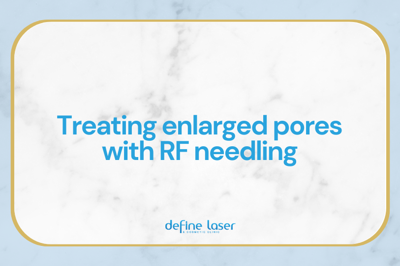 2026-03 blog header image (1)